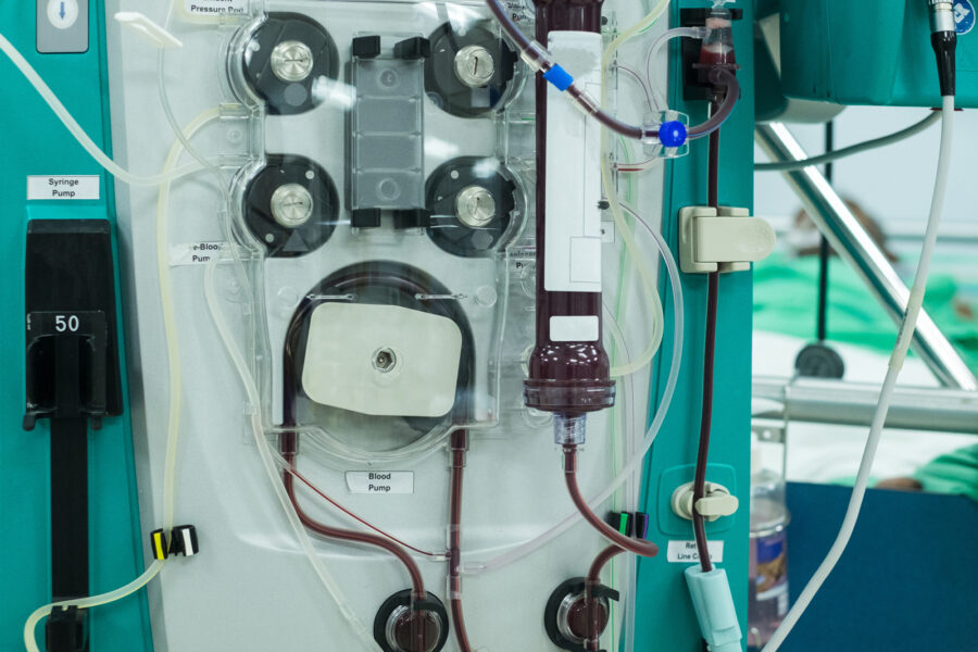 Blóðskilunarvél, er að hreinsa blóð úr manneskju með nýrnabilun sem liggur á rúmi bakvið vélina.